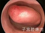 可能的病灶有哪些?